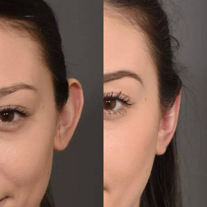 Pince correctrice d'oreilles